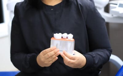 Dental Crowns in Nanaimo, BC